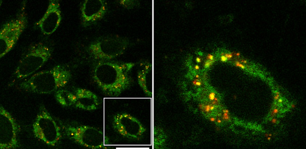 Acumulación de nanoplásticos (marcados en verde) en el interior de células tiroideas, y su co-localización en los lisosomas (marcados en rojo), que da lugar al color amarillo. Imagen extraída del artículo.